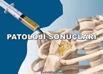 Patoloji Sonucu Öğrenme
